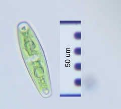 Closterium navicula