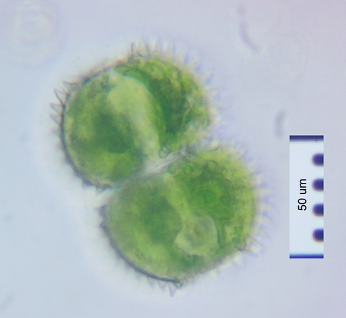 Cosmarium eloiseanum