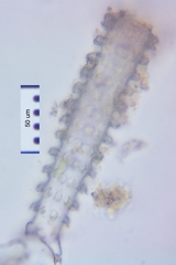 Triploceras verticillatum