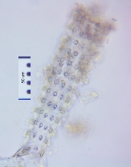 Triploceras verticillatum