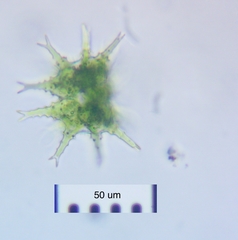 Staurastrum furcigerum