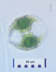 Staurastrum cerastes