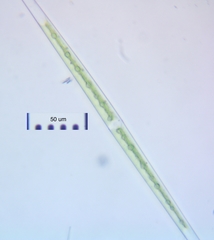 Closterium aciculare