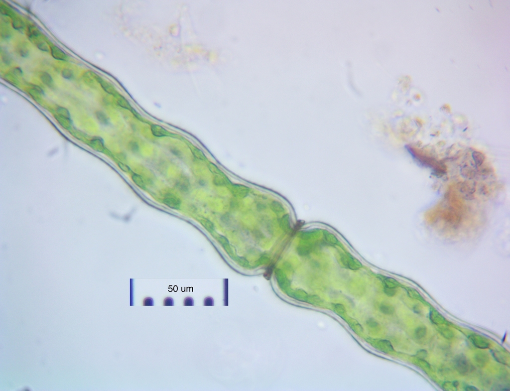 Pleurotaenium constrictum
