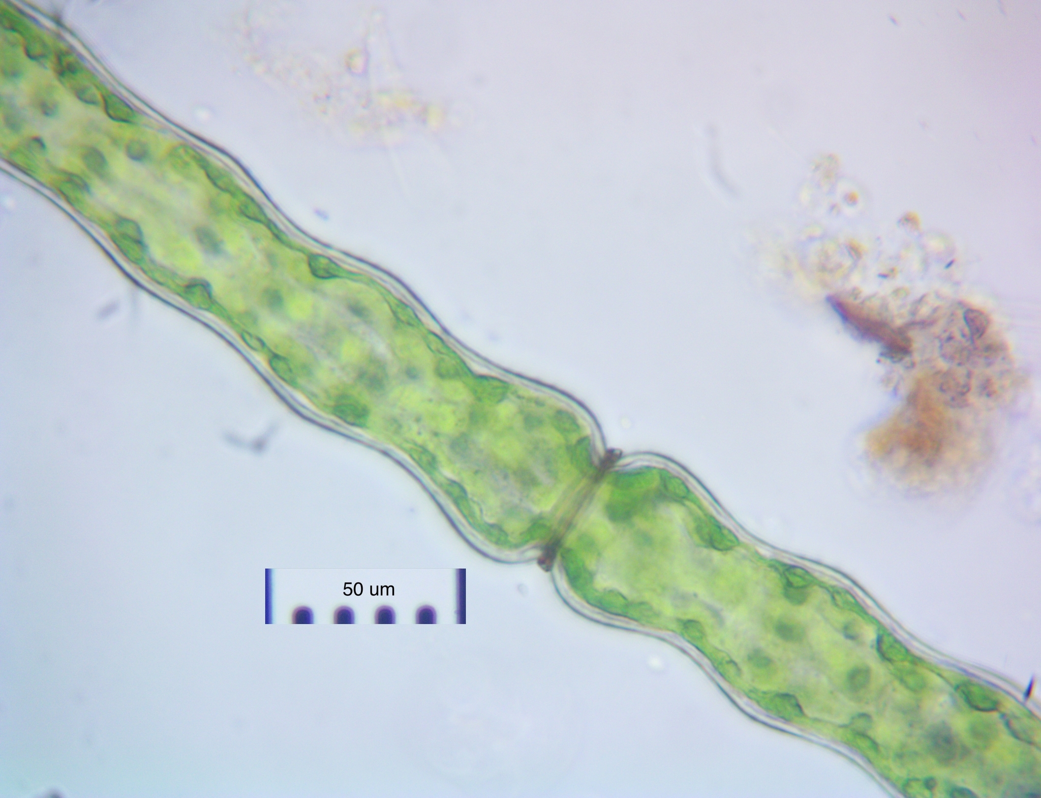 Pleurotaenium constrictum