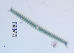 Triploceras verticillatum