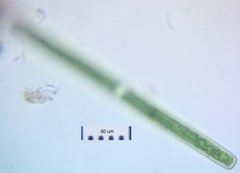 Haplotaenium minutum