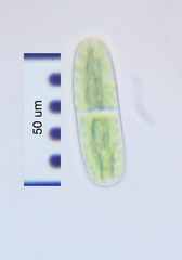 Cylindrocystis