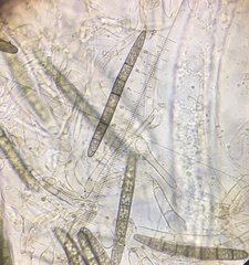 Geoglossum umbratile