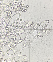 Entomophthoraceae