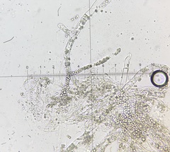 Entomophthoraceae