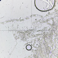 Entomophthoraceae