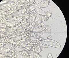 Entomophthoraceae