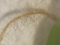 Botrytis