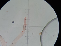 Botrytis