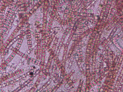 Planktothrix rubescens