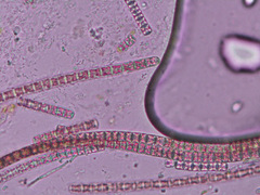 Planktothrix rubescens