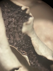 Xanthoparmelia neochlorochroa