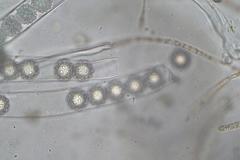 Octospora maireana