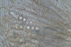 Pulvinula tetraspora