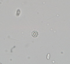Mesodinium pulex