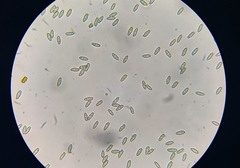 Tylopilus ferrugineus