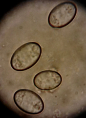 Morchella rufobrunnea