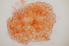 Cristulariella depraedans