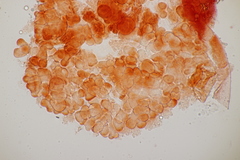 Cristulariella depraedans