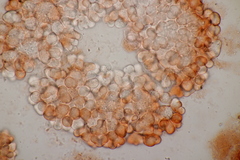 Cristulariella depraedans