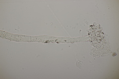 Cristulariella depraedans