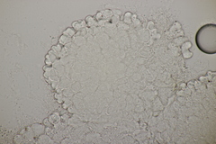 Cristulariella depraedans