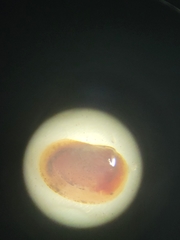 Cyzicus