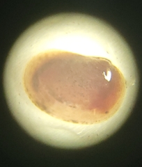 Cyzicus