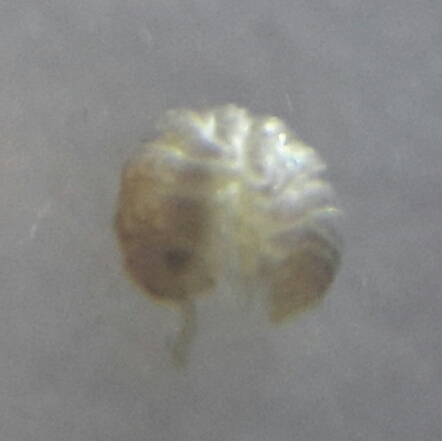 Armadilloniscus lindahli