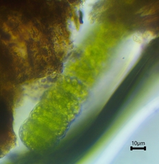 Hyalotheca