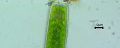 Pleurotaenium