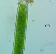 Pleurotaenium