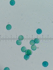 Trichia crateriformis