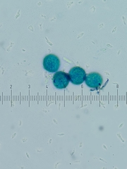 Trichia crateriformis