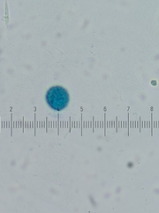 Trichia crateriformis