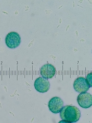 Trichia crateriformis