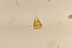 Licmophora