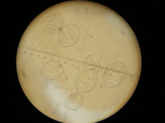 Erysiphe corylacearum