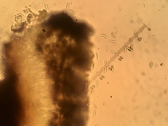 Cresponea chloroconia