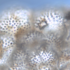 Planorbulina