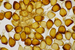 Uromyces viciae-fabae