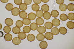 Uromyces trifolii-repentis fallens