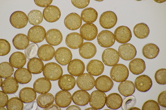 Uromyces trifolii-repentis fallens