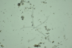 Endectyon hispitumulus